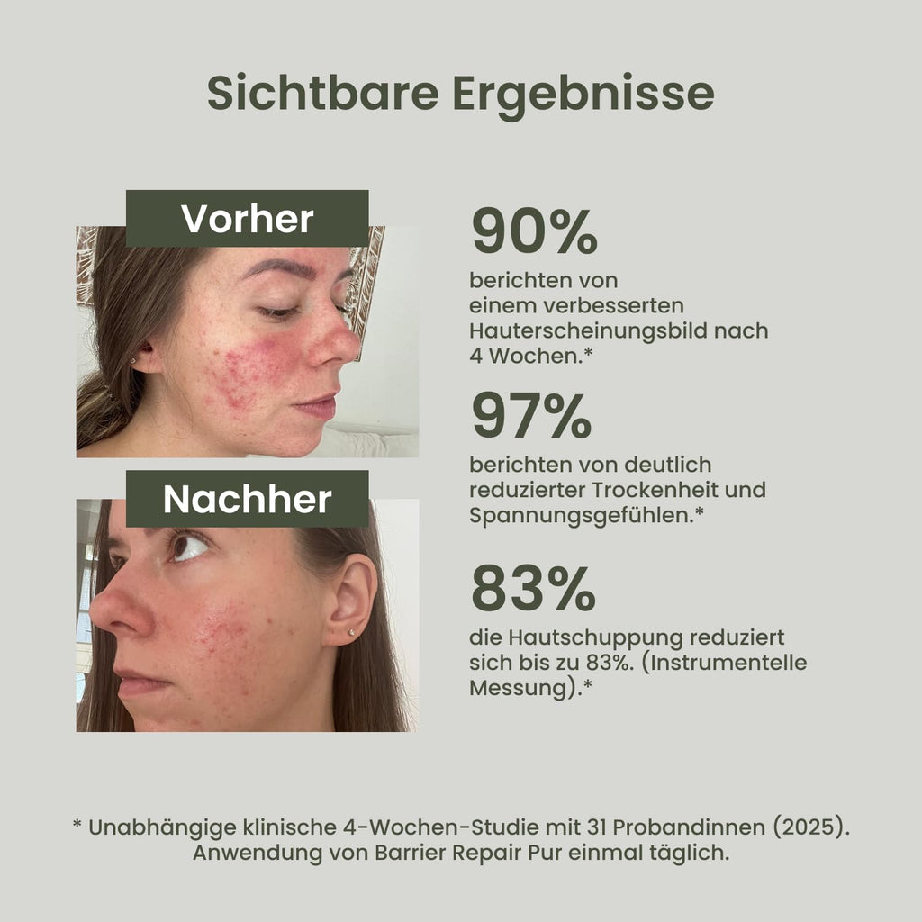 TALLOW Naturals Barrier Repair Pure - Known from the Lion Cave - 100% Organic Beef Tallow Cream, Organic Beef Tallow Skincare, from Germany from Grass-Fed Cattle (120 ml)