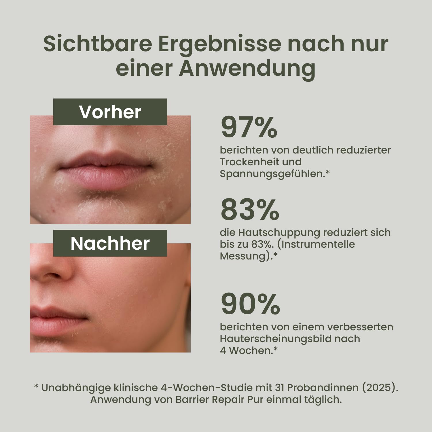 TALLOW Naturals Barrier Repair Pure - Known from the Lion Cave - 100% Organic Beef Tallow Cream, Organic Beef Tallow Skincare, from Germany from Grass-Fed Cattle (120 ml)